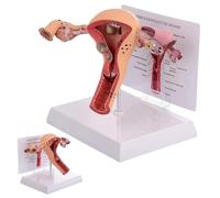 Modello di utero e ovaio femminile, modello di utero patologico, modello di organo riproduttivo femminile, modelli anatomici di utero umano con scheda didattica e base