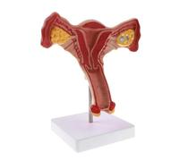 Modello di utero femminile a grandezza naturale in scala 1:1 con ovaie e tube di Falloppio, visualizzazione anatomica del sistema riproduttivo Modello di organo