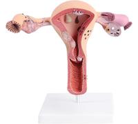 Modello di utero patologico, modello anatomico degli organi riproduttivi femminili, strumento dimostrativo for l'insegnamento scolastico, sussidi didattici for la riproduzione