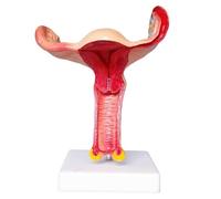 Modello di utero Sistema riproduttivo Utero femminile Ovaio Modello anatomico Ovaio in PVC Ingrandimento Insegnamento medico for la scuola Attrezzatura da laboratorio medico