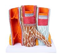 Modello di vaso sanguigno ingrandito 14x, anatomia di arterie e vene umane con dimostrazione di arteriosclerosi, modello cardiovascolare artero-venoso umano, modello anatomico di vasi