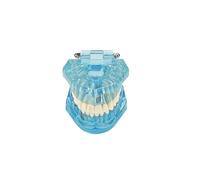 Modello didattico dentale Anatomia stampo Modello dentale trasparente Malattia Denti trasparenti Dentista Standard Malattia Rimovibile Patologia Didattica