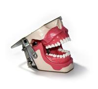 Modello didattico di anatomia dentale, modello di estrazione in anestesia dentale, pratica didattica di chirurgia orale per l'estrazione di un dente, dimostrazione standard di patologia dentale