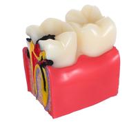 Modello didattico di anatomia dentale: strumento didattico comparativo per la