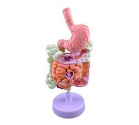 Modello didattico di anatomia patologica, gastroi patologici