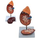 Modello didattico di anatomia renale e ghiandole surrenali ingrandito 1.5X