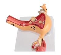 Modello didattico di lesione uterina, modello di organi interni ed esterni femminili, modello anatomico in PVC, modelli scientifici di anatomia umana, utilizzati for la ricerca scientifica in classe.
