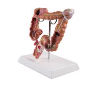 Modello Didattico, Modello di Anatomia 'Intestino Crasso Umano Modello di L1387