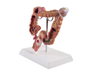 Modello Didattico, Modello di Anatomia 'Intestino Crasso Umano Modello di L1387