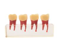 Modello Didattico Odontoiatrico di Anatomia Orale Elementi Rimovibili | Resina, Pratica Endodontica, Supporto Comunicazione Paziente, per Cliniche e Scuole, Elementi Primari