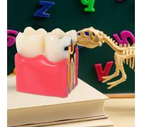 Modello didattico per la carie dentale: modello di studio comparativo dei denti