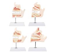 Modello dimostrativo dello sviluppo dei denti per l ' insegnamento e l ' apprendimento della orale con struttura dettagliata e modello crescita dei denti verbali facile da montare