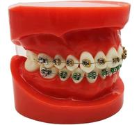 Modello Dimostrativo di Ortodonzia Dentale, Modello di Brackets Ortodontici Dentali, Modello di Denti di Tipodonte con Simulazione di Brackets Mentali Denti Ortodontici Orali