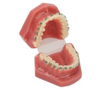 Modello dimostrativo ortodontico dentale con fili metallici e bracket