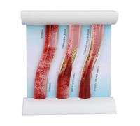 Modello dinamico vena arteria sussidio anatomico vaso sanguigno Dynamische | Dimostrazione vascolare in plastica, mostra il cambiamento dei vasi, for l'educazione studio della fisiologia