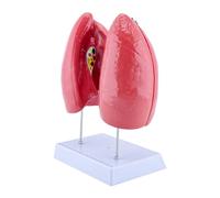 Modello educativo dell'anatomia polmonare umana anatomica con componenti rimovibili. Anatomia e struttura respiratoria