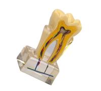 Modello educativo di anatomia dentale per l'insegnamento | U6X, modello anatomico ingrandito per denti e nervi, per dimostrazione aule e cliniche