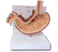 Modello educativo simulato Modello di Anatomia dello Stomaco Umano Modello di Stomaco malato Modello di dimostrazione della malattia dello Stomaco Modello di Stomaco patologico