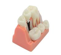 Modello flessibile dei denti Modello di impianto del dente per lo studio Modulo didattico per scienze mediche Dentista Odontoiatria Impianto Analisi dei denti Ponte della corona Rimovibile