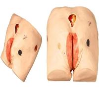 Modello for la Cura delle Ulcere da Decubito, Modello Anatomico Avanzato delle Ulcere da Pressione, Simulatore Infermieristico for Piaghe da Decubito, for Competenze di Formazione Medica