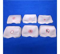 Modello Indossabile per Assistenza Infermieristica Sull'Ulcera da Decubito, Set da 6 Pezzi Piaghe da Decubito per Ogni Fase Modello Infermieristico per Formazione Infermieristica E Materiale Didatti