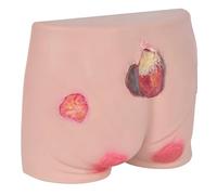 Modello infermieristico per ulcera da pressione, simulazione di piaghe da decubito a quattro stadi, materiale morbido in silicone per la valutazione e la classificazione delle ferite