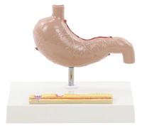Modello Medico di Stomaco Umano, Modello di Anatomia gastrica, patologia dello Stomaco, Anatomia, for Studio e dimostrazione didattica degli Studenti