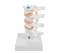 Modello Mini di Colonna Lombare in PVC Bianco | Confronto Osseo e Osteoporotico, per Clinici e Docenti di Geriatria in Aula