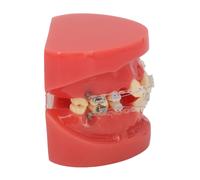 Modello ortodontico in ceramica con fili e brackets per insegnamento