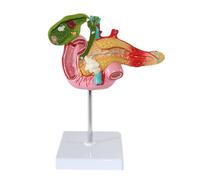 Modello Pancreatico Patologico Calcoli Biliari Modello Anatomico Pancreatico
