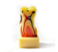 Modello parodontale Dentale,Modello di carie dentale del dente della carie dentaria del modello dei denti per l'istruzione e la spiegazione del paziente