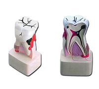 MODELLO PATOLOGIA DENTALE