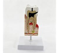 Modello Patologia Dentale Resina Studio Dentistico Studio Carie Gengive-Model