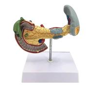 Modello patologico del pancreas Modello patologico del pancreas Duodeno e cistifellea Fisiologia Educazione Modello anatomico di organo umano for studi medici e aule