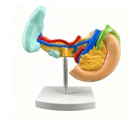 Modello patologico di pancreas, milza e duodeno umani-Model | Modello a grandezza naturale 1:1|Mostra il cancro al pancreas, i calcoli biliari, la rottura della milza e l'ulcera duodenale