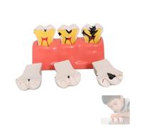 Modello Per Dentista - Modello Di Dente Realistico In Pvc Per Modelli Di Apprendimento, Insegnamento, Pratica E Formazione