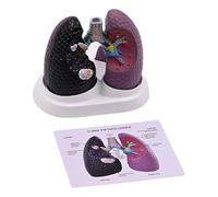 Modello polmonare anatomico modello polmonare realistico patologico modello di anatomia polmonare per insegnamento dimostrativo e uso educativo strumento didattico