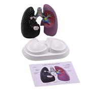 Modello polmonare anatomico umano Modello di anatomia polmonare normale e patologica per contesti clinici Insegnamento e relazione sulle lezioni