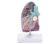 Modello polmonare di patologia, Modello anatomico del polmone Umano 3D con Struttura Anatomica accurata per Modelli didattici Comunicazione Medico-paziente