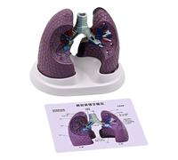 Modello polmonare patologico anatomico Modello di anatomia polmonare normale e patologica per l'insegnamento Ricerca Impostazioni cliniche Anatomia realistica