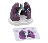 Modello polmonare patologico anatomico modello normale e patologico di anatomia polmonare per l'insegnamento di ricerca Impostazioni cliniche
