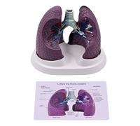 Modello polmonare patologico anatomico modello normale e patologico di anatomia polmonare per l'insegnamento di ricerca Impostazioni cliniche