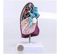 Modello polmonare umano - Modello anatomico per l'insegnamento del polmone malato a grandezza naturale 2:3 per l'aula scientifica e lo studio medico, comunicare con i pazienti