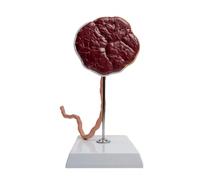 Modello professionale di placenta con cavo ombelicale trasparente, PVC | Modello educativo della placenta ostetricia che mostra le strutture del cordone ombelicale per studenti e operatori sanitari