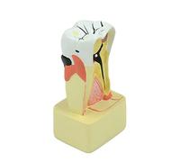 Modello realistico dei denti del modello di analisi di patologia per la comunicazione medico-paziente della clinica