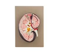Modello Rene - Modello Didattico Anatomico Ingrandito 3x