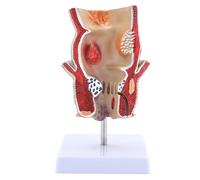 Modello Retto Umano Per La Scuola Laboratorio Patologie Umane Del Modello Retto Anatomy Medical Strumento Insegnamento Patologie Anatomiche Assistenza Didattica Per La Scuola