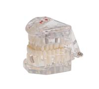 Modello Rimovibile Per Insegnamento, Modello Di Denti Trasparente in Resina Per Dimostrazione Di Orali, Strumento Educativo Per Dentisti E Studenti