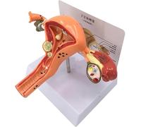 Modello riproduttivo uterino patologico Modello di insegnamento dell'utero patologico del modello di anatomia ovarica modello di genitali femminili per i medici studiano le malattie