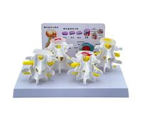 Modello scheletro umano per anatomia della colonna vertebrale lombare lesioni a 4 stadi Vertebre lombari comparative Modello scheletro umano infermieristico Umano